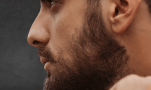 man-with-beard-cowlick-on-cheek